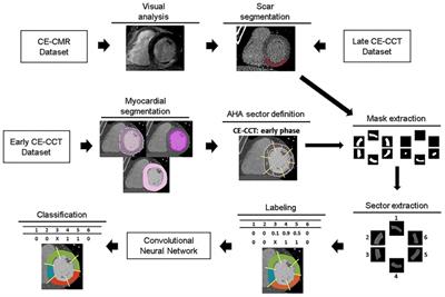 A deep-learning approach for myocardial fibrosis detection in early contrast-enhanced cardiac CT images